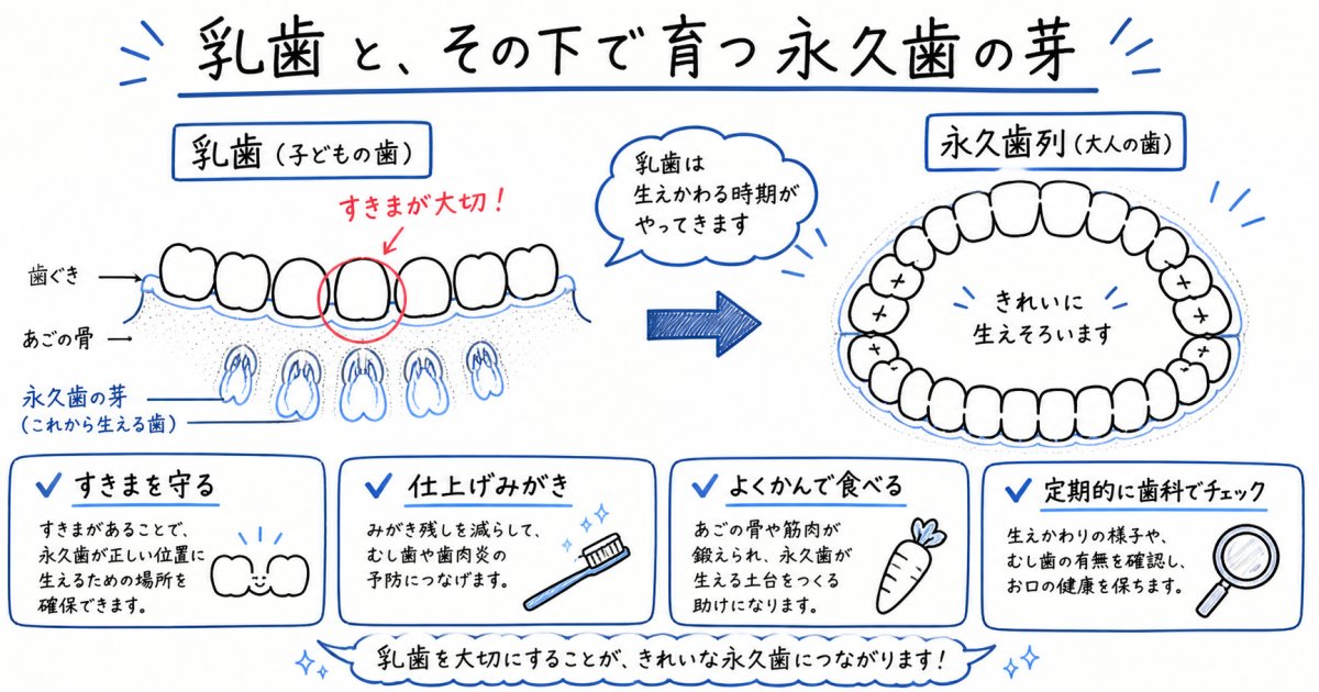 乳歯のむし歯は歯並びに影響する?永久歯を守る原因と家庭の予防策